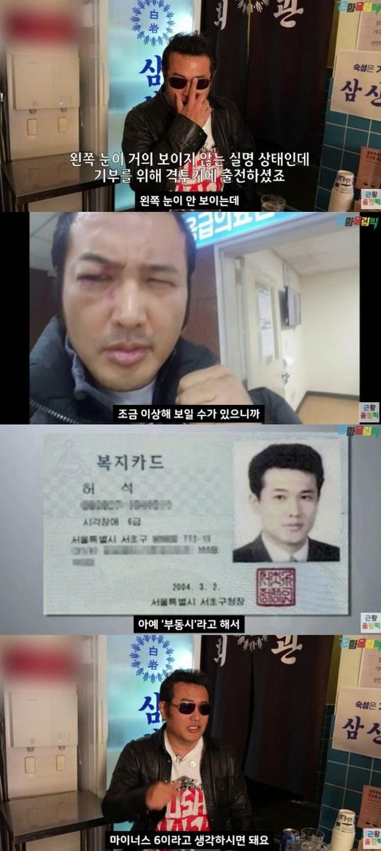 “솔직히 실명이라 괜찮다”…김보성, 오른쪽 눈까지 위기→고백 쏟아냈다