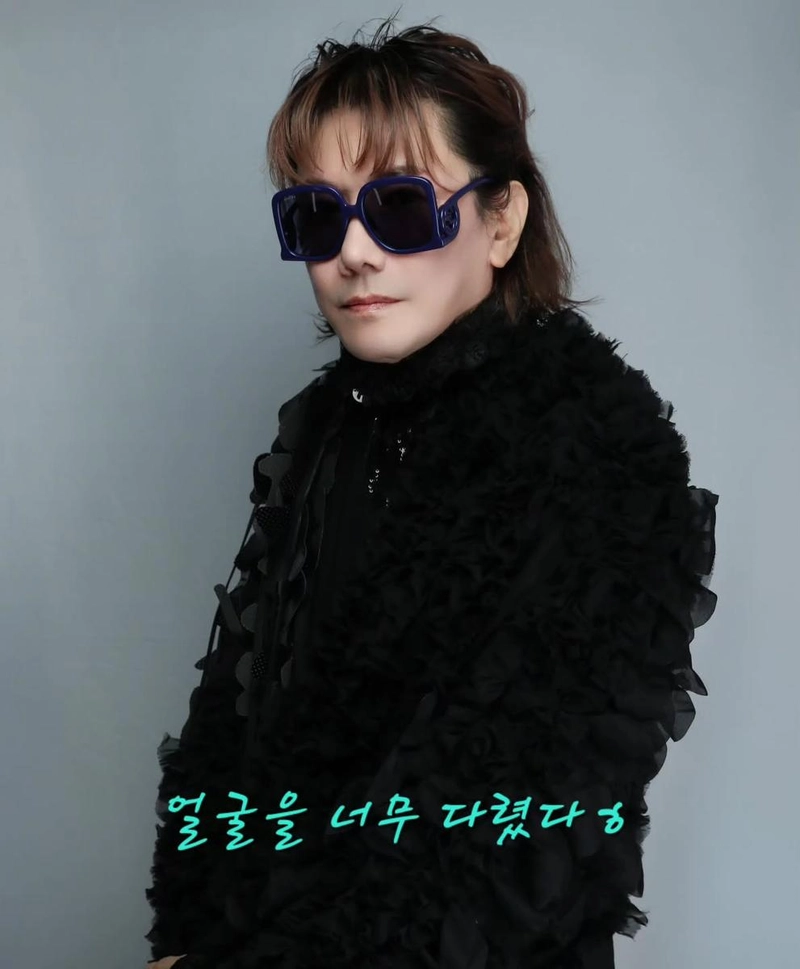 “얼굴을 너무 다렸네요”…김장훈, 솔직한 고백→시선 압도한 흑패션 / 가수 김장훈 인스타그램