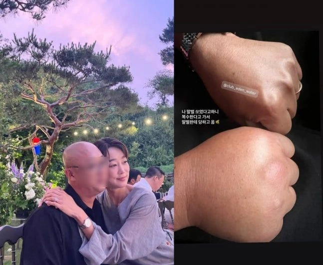 “최여진, 신혼의 일상”…‘7세 연상 남편과 말벌 복수’→두 손 붓고 웃음