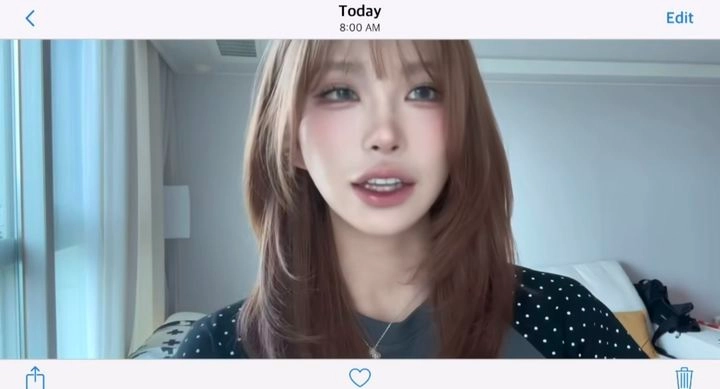 “성형 후 자신감 더했다”…최준희, 달라진 눈·광대→솔직 후기 주목