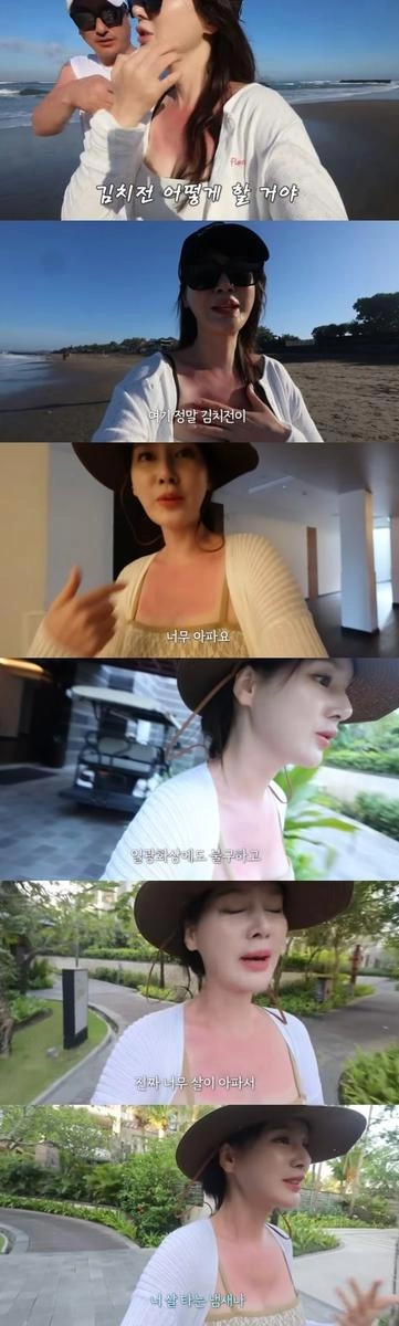 “화상 고통에 멈춰 선 여름”…이혜원·안정환, ‘발리 여행’ 속 진짜 가족의 하루→애틋함 남았다