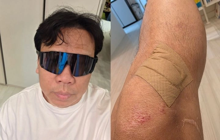 “오지헌 빗길 낙차 고백”…사진 속 부상 흔적→SNS 팬들 걱정 쏟아져
