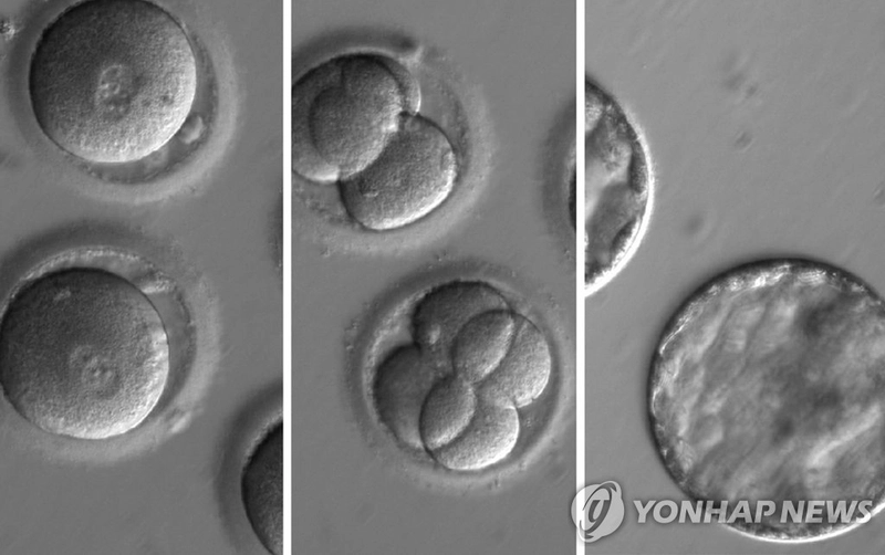 美 ‘오키드헬스’ 유전체 서비스 논란…비용 부담에 사회 불평등 우려