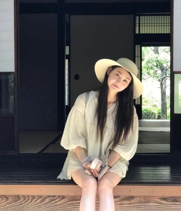 윤주 인생을 바꾼 기적…간이식 4년 만에 전한 진심