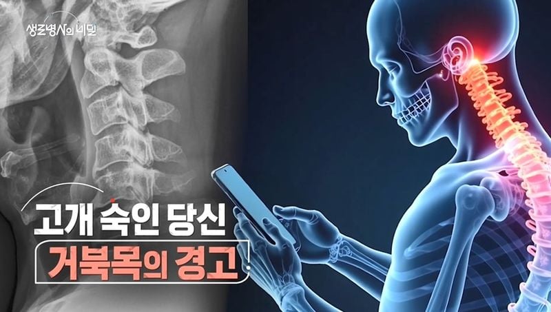 “고개 숙인 일상”…생로병사의 비밀, 거북목 증후군 경고→스마트폰 시대 건강의 신호