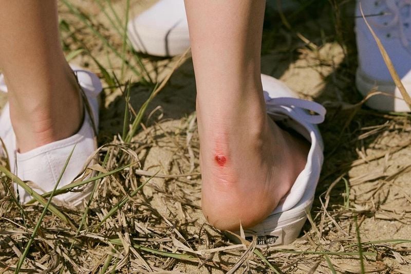 “사랑처럼 아려온 순간”…조이, 풋풋한 여름날→상처마저 빛난다 / 걸그룹 레드벨벳 조이 박수영 인스타그램