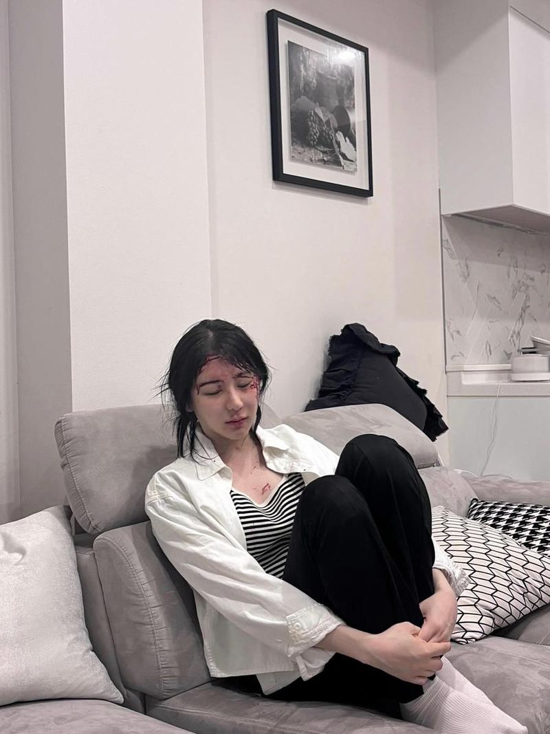 “사코죽타”…이채연, 흐트러진 순간→감정의 파장 / 걸그룹 아이즈원 이채연 인스타그램
