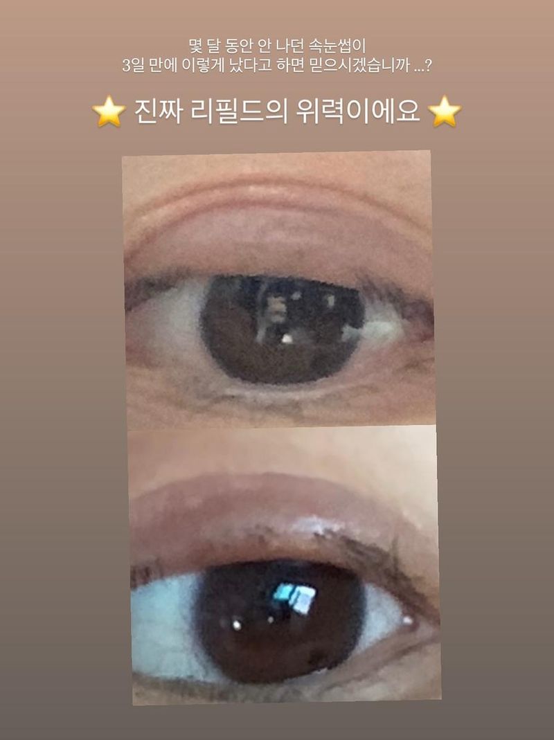 “네…바로 과거 제 속눈썹인데요”…박지우, 솔직 고백→회복의 기록 / 걸그룹 러블리즈 진 박지우 인스타그램