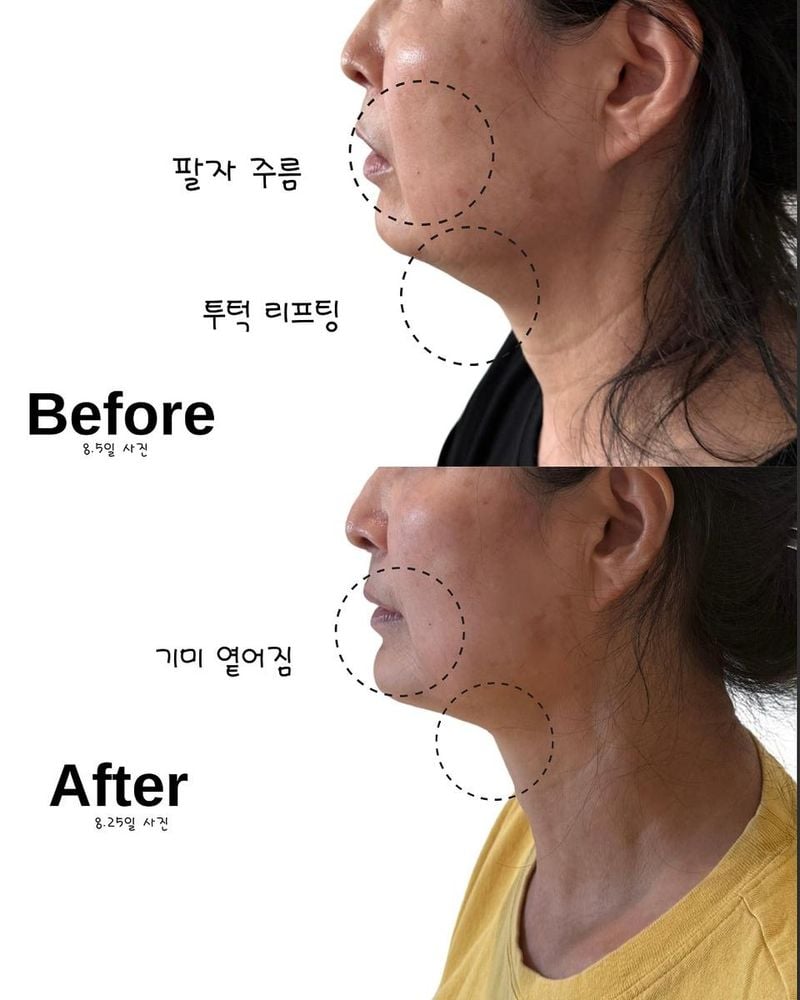 “속건조 잡는 리프팅”…지소연, 환한 변화→피부광채 근황 / 배우 지소연 인스타그램