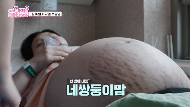 “20년 만의 감동 재회”…장서희·김찬우, ‘우리 아기가 또 태어났어요’서 출산 현장 동행→가족의 의미 환기