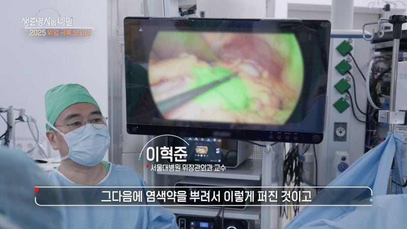 “침묵의 암, 조기 발견의 힘”…‘생로병사의 비밀’ 위암 환자들, 내시경과 항암의 여정→완치 희망 비추다 / KBS