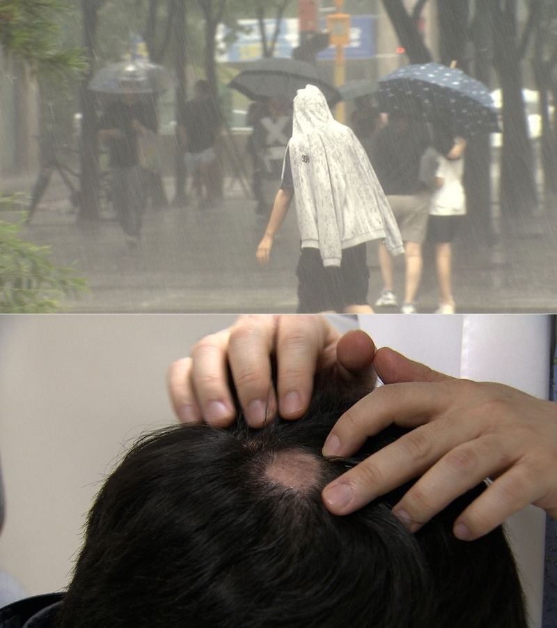 “비 맞아도 괜찮을까”…‘뉴스토리’ 탈모 괴담 해부→진짜 원인에 다가서다 / SBS