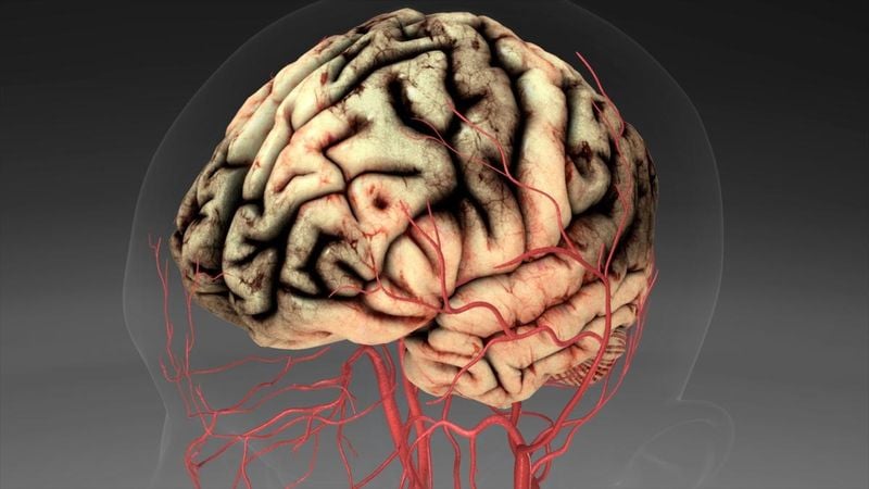 숨은 방아쇠 밝힌다…‘생로병사의 비밀’ 뇌졸중, 심장·잠·치주염→예방의 실마리