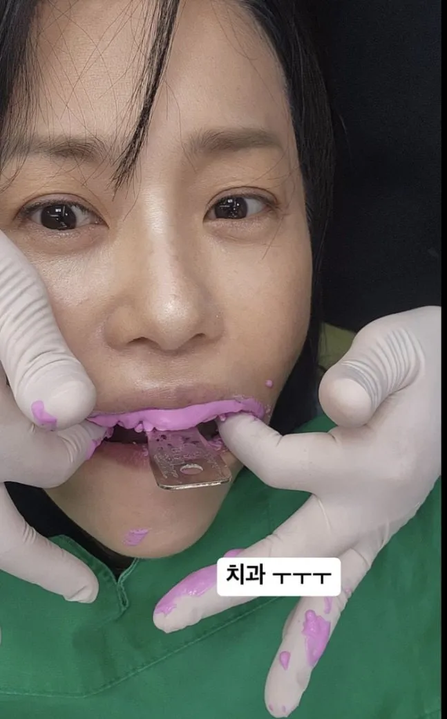 “치과에서도 솔직하게”…고현정, ‘사마귀’ 앞두고 일상 속 진심→팬들 뭉클