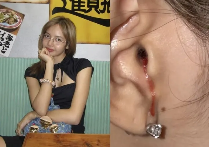 “귀에 맺힌 의문의 피”…블랙핑크 리사, 일본 사진 속 팬 걱정→월드투어 신곡 무대 기대