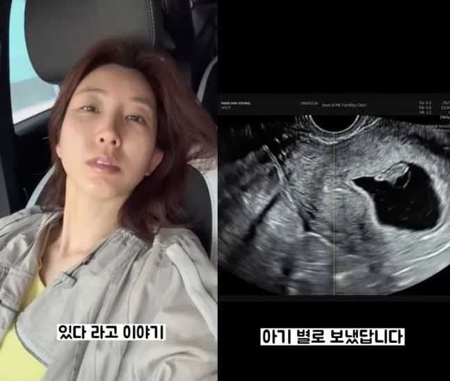 “울컥한 고백”…박인영, 소중한 아기별 이야기→회복에 담긴 진심